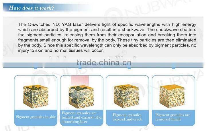 ND YAG laser depigmentation skin color machine