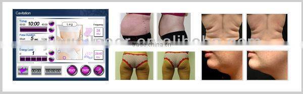 New arrival multifunction cavitation and ultrasound beauty equipment