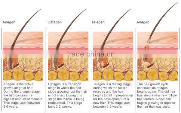 LED therapy infrared laser hair loss