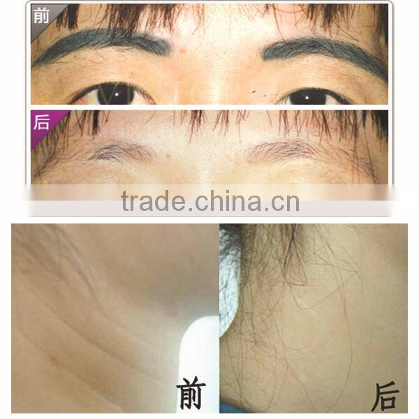 multifunction elight rf laser multi light ipl machine 3 in 1 facial care system