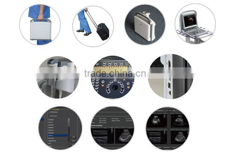 Medical Veterinary equipment trolley Color Doppler ultrasound machine system