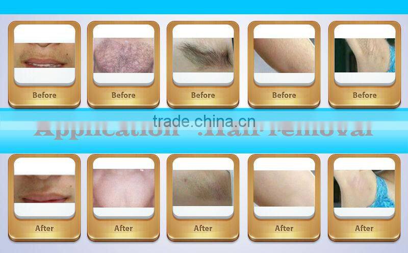 Hot selling 10 IN 1 IPL beauty machine with RF, Cavitation, Vaccum