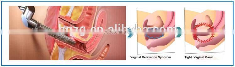 New arrival beauty machine vaginal tightening best rf fractional co2 laser