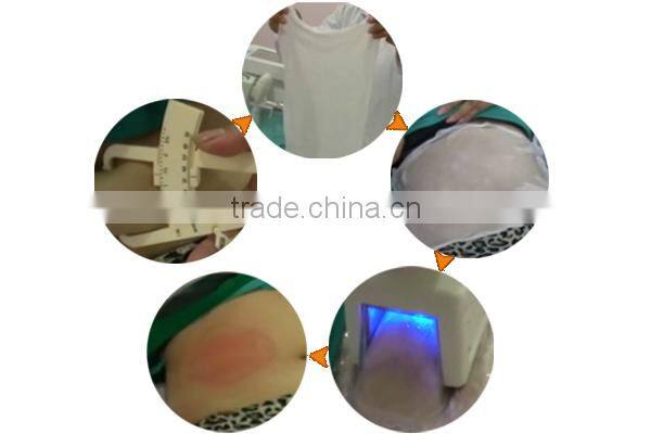 NEWS! Sales Promotion professtional 2 hand pieces Cryolipolysis cryo liposuction machine