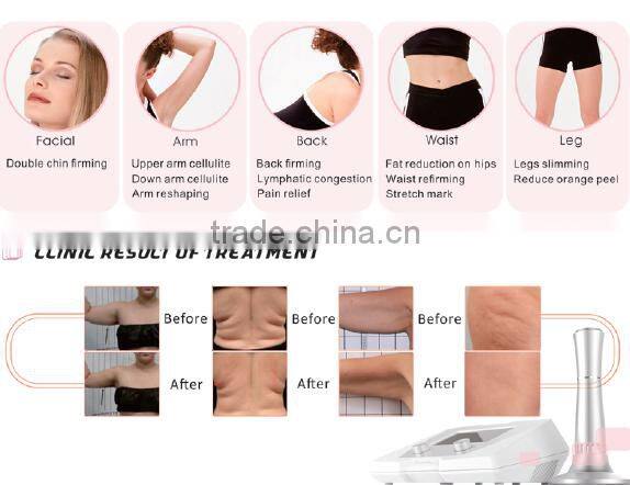 beauty medical equipment/ultrasonic slimming equipment/lose weight equipment