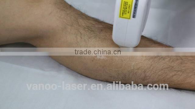 808nm diode laser hair removal beauty equipment with CE certificate
