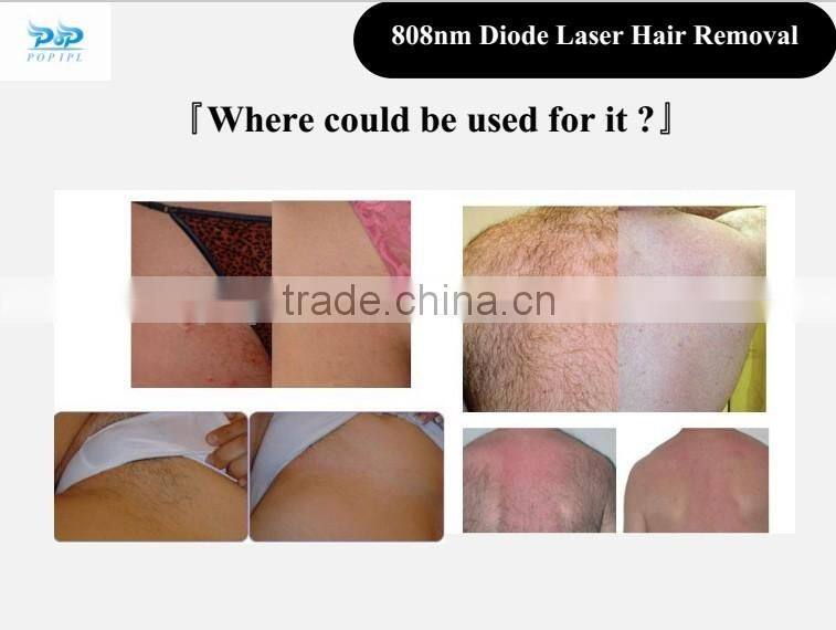 Permanent hair removal and skin rejuvenation DL8