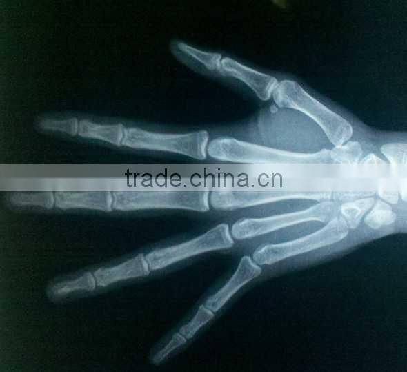 Konida dental hot sex 14*17 agfa medical filmagfa holder fuji dry film