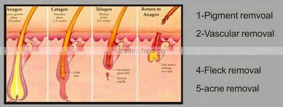2015 Hot IPL Elight SHR Three in One Permanent Hair Removal Machine With CE Approved for Skin Rejuvenation and Hair Removal