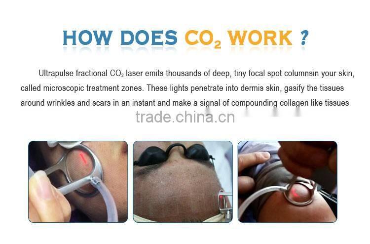 2016 Alibaba express scar repair beauty equipment Fractional CO2 Laser with usa imported laser tube