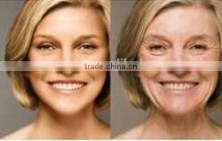 2014 hot sale Portable Renovation and skin lifting Machine ultrasonic cavitation rf vacuum with CE approve