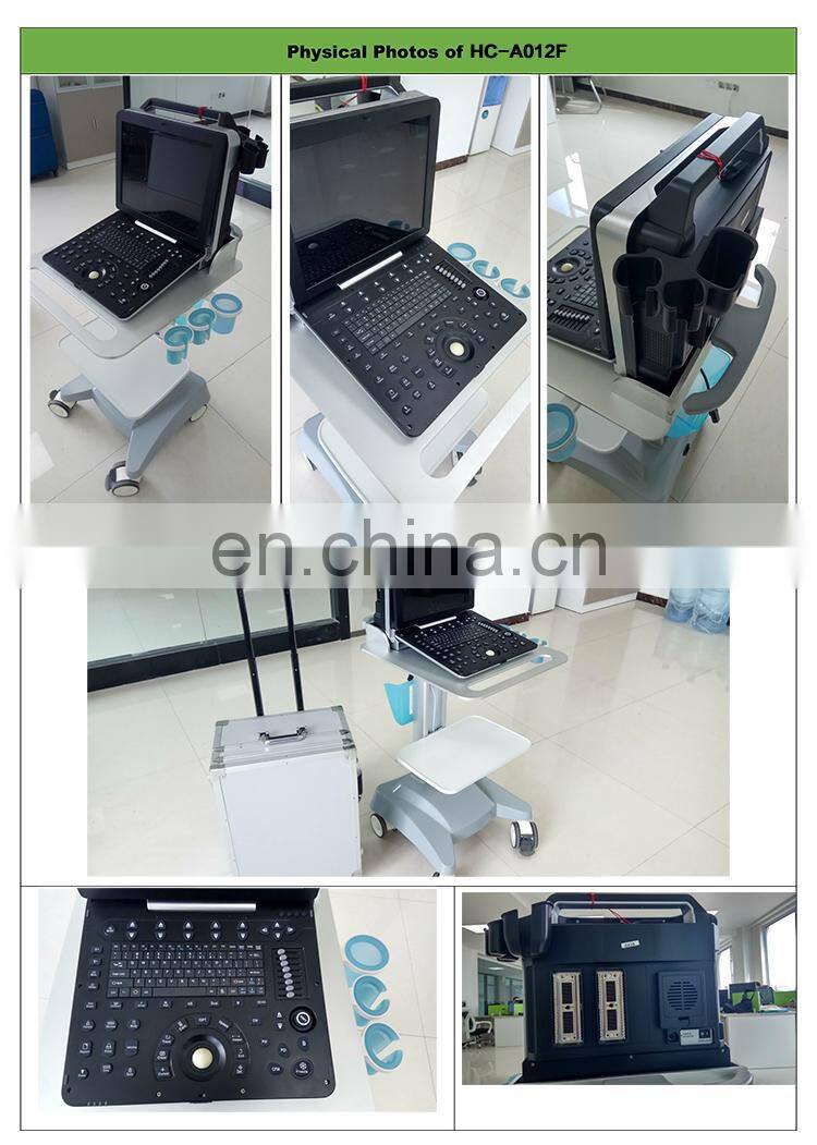HC-A012F Ultrasound Scanner The Most Economical Portable Color Doppler Ultrasound Scanner color doppler ultrasound machine