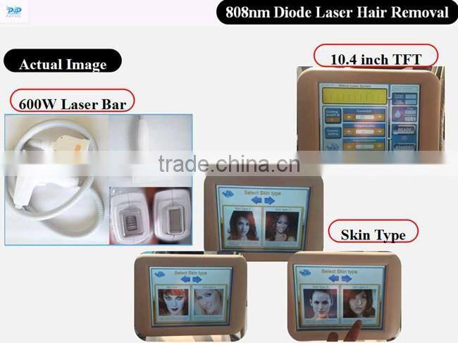 808nm Diode Laser machine for hair removal laser hair removal machine