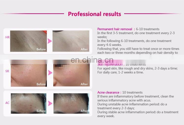 DEESS New products mini laser ipl hair removal skin care product for women