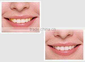 China Dental Supply Business Opportunities distributor