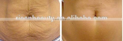 Professional 180/600/1200 Needles Derma Roller/ 3 in 1 Derma Roller Kit/ Medical Grade Derma Roller