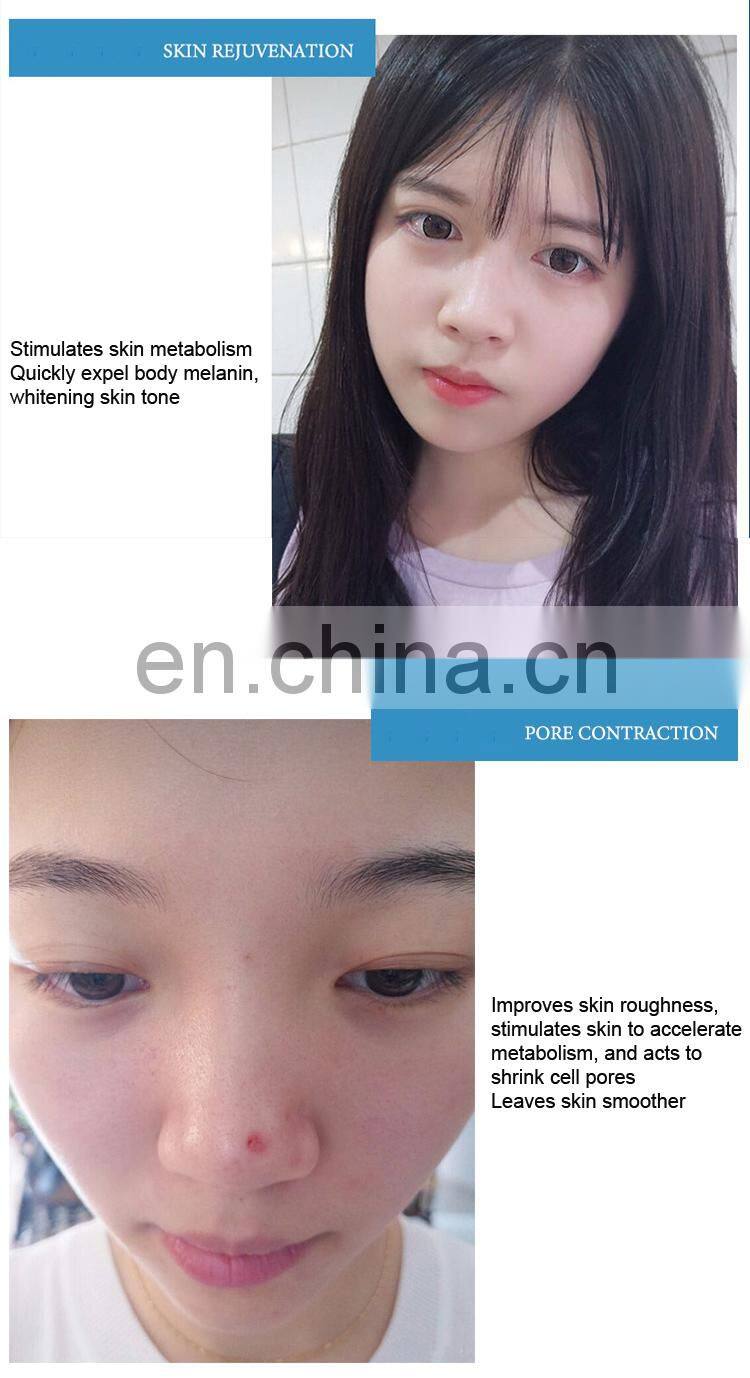 Noninvasive Water Mesotherapy Wrinkle Removal Skin Tightening Machine