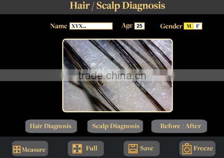 hair analysis machine in Skin Analyzer hair analysis equipment