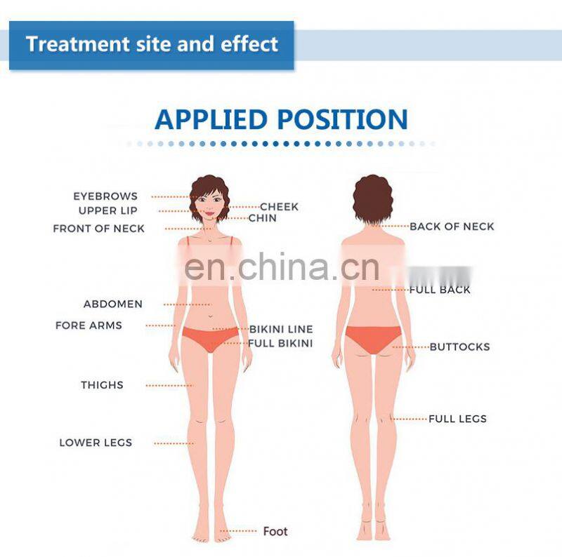 3 in 1 wavelengths 1064nm/808nm/755nm laser hair removal machine