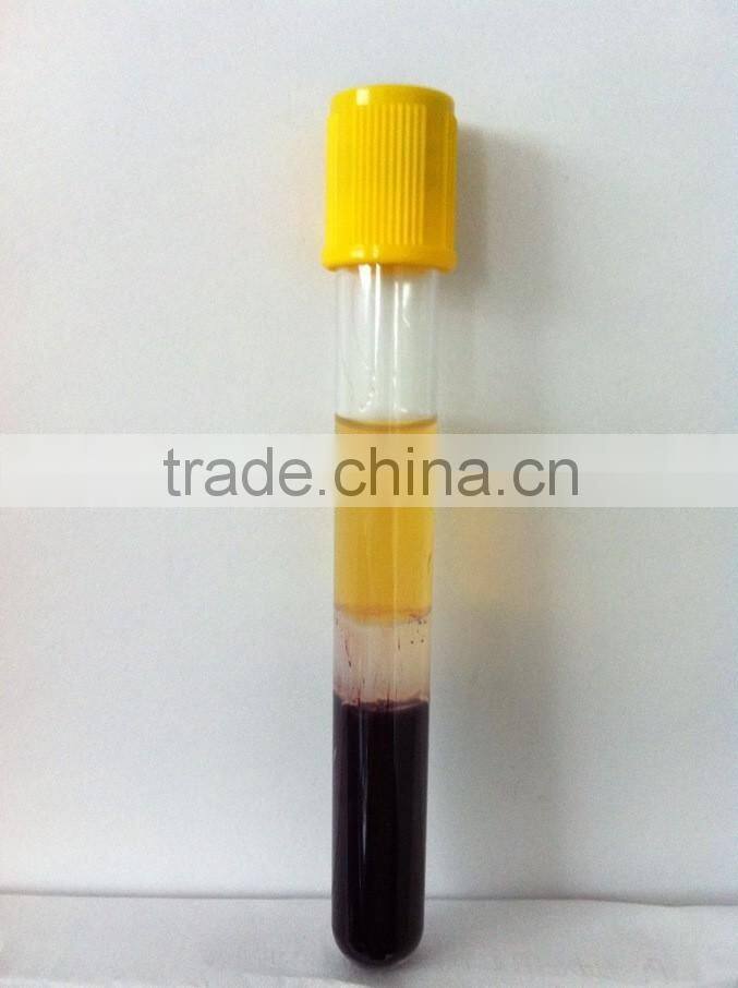 Gel and Clot activator blood tube sst tube