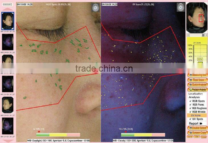 portable skin analyze machine/uv skin analyzer/skin analyzer
