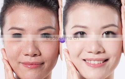 Best no needle cooling RF skin beauty machine for home use