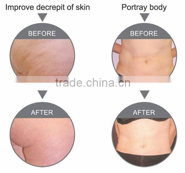 Weifang Huamei RF slimming machine