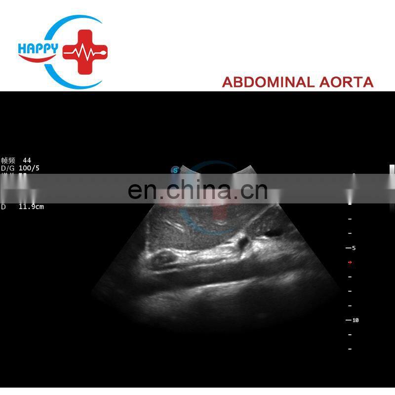 High specification Ultrasound color doppler/Sonoscape ultrasound/Sonoscape s12 4d color doppler ultrasound price