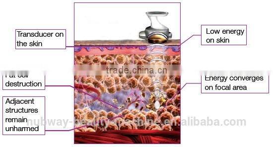 HIFUSHAPE Body Slimming Portable HIFU Ultrasound Fat Burning Machine