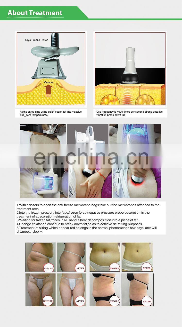 2019 Powerful New Double Cryo cavitation Rf slimming machine for Salon Use