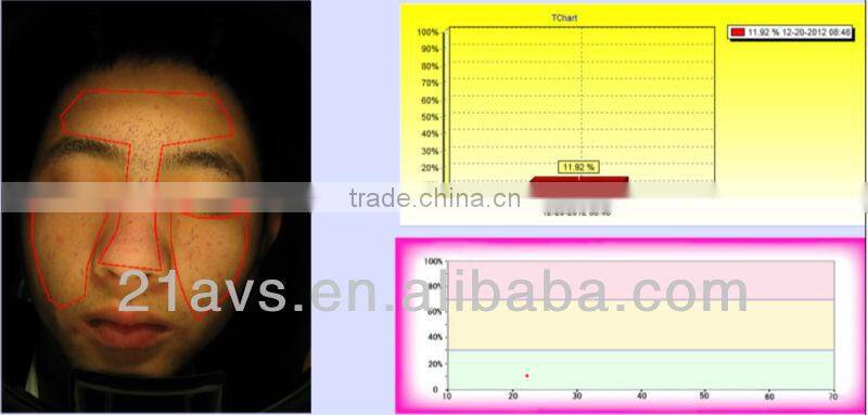 Professional Facial Skin Analyzer Magic Mirror with software system for beauty salon