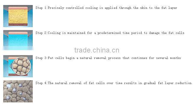 Best Price fat effective cryolipolysis cavitation slimming frozen fat