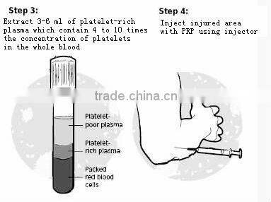 facial use blood collecting tube( PRP tube)