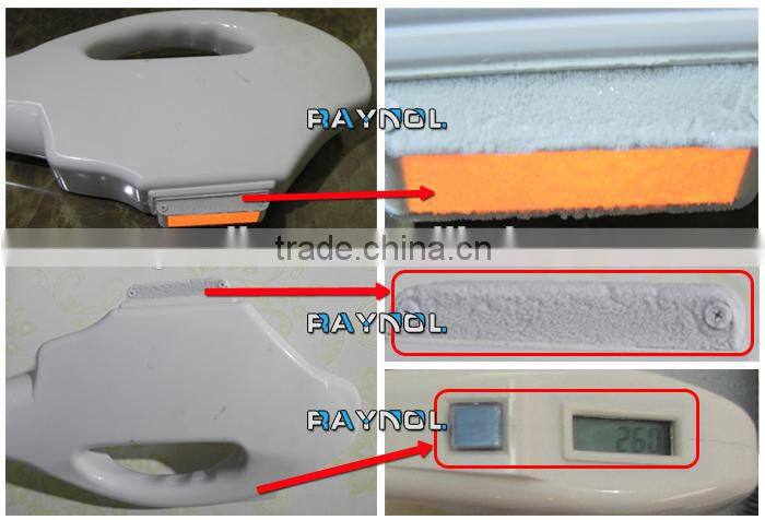 Permanent Laser Hair Removal Beauty IPL SHR Machine