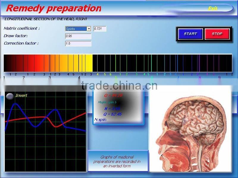 2016 Best selling 3d nls quantum resonance magnetic body health analyzer