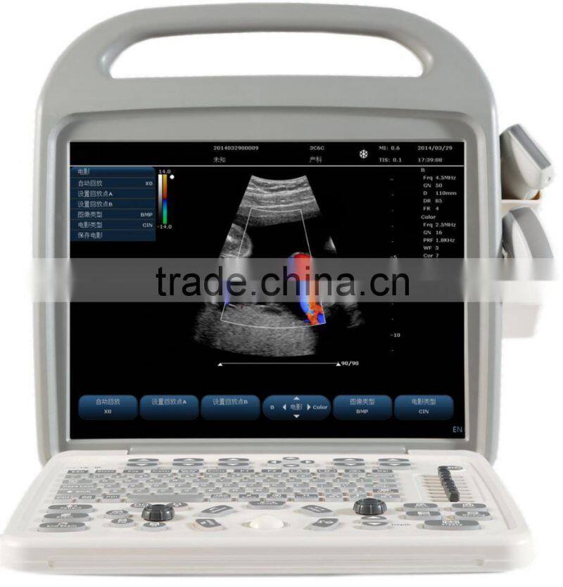 factory SUPPLY portablolor ultrasound machines/ultrasound scanner CE approval doppler ultrasound scanner