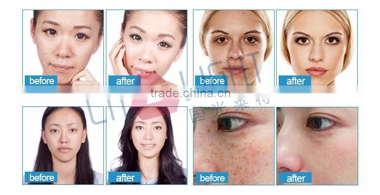 Merry christmas! Skin Rejuvenation Photon Led Light Therapy Beauty Machine