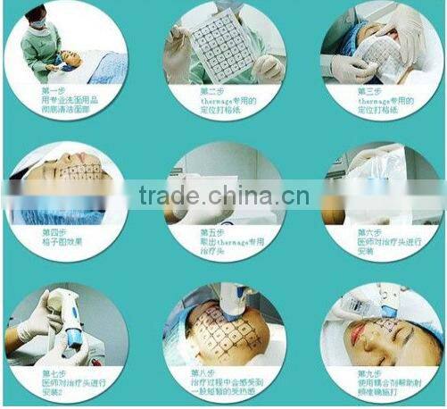 fractional RF beauty equipment for skin lifting wrinkle removal