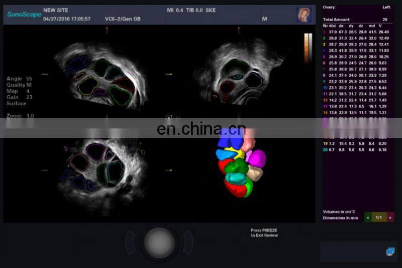 Competitive hospital medical equipment trolley Sonoscape 4d /Ultrasound scanner /Sonoscape S50 Elite