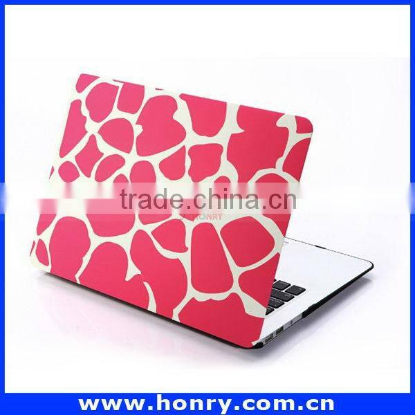 Top level Cheapest hard cover case for macbook air 11