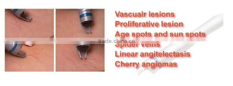 New 980nm RBS Vascular Therapy Red Spider Veins Removal Machine