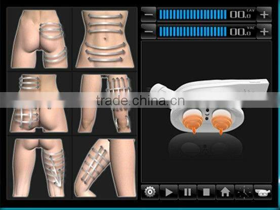 Coolipo V9 Cavitation Machine