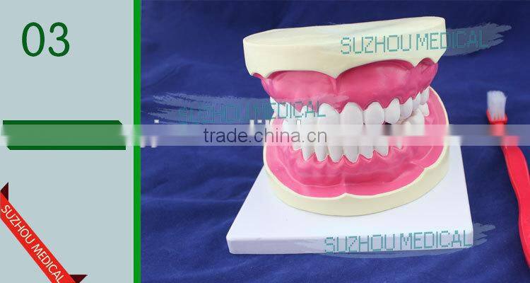 Teeth care model