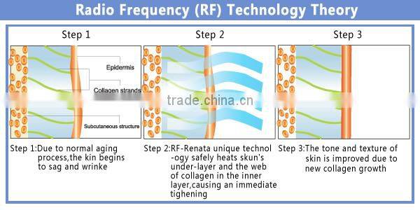 E6S Multifunction Beauty Machine IPL RF Laser ND YAG for Tattoo Removal
