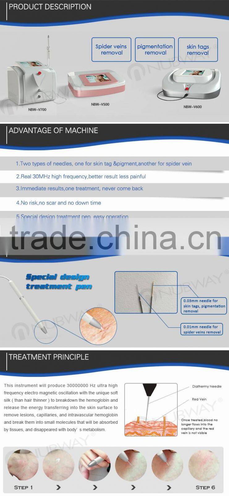 2016 Special promotion !!! High frequency thermocoagulation spider vein removal machine