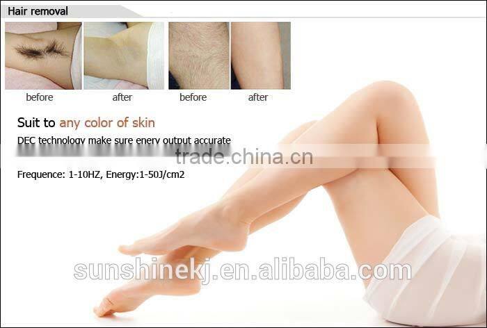 Strong power CE TUV approved 3000w SHR hair removal elight skin rejuvelation ipl italian