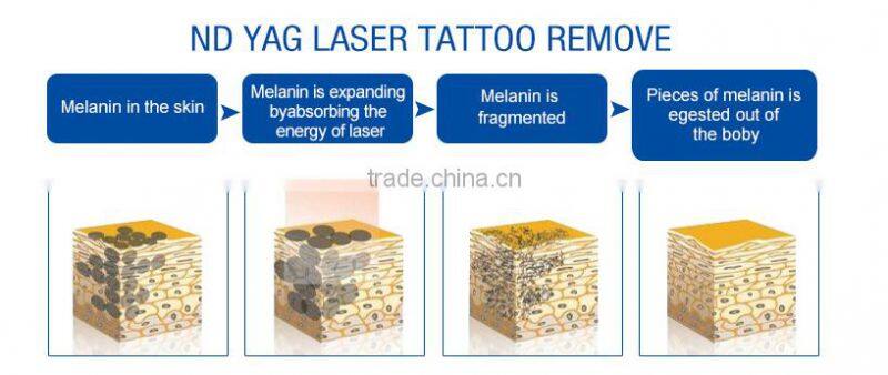 Most advanced IPL SHR Nd yag machine