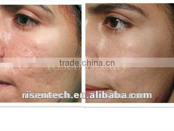 home use skin care facial mask LED mask