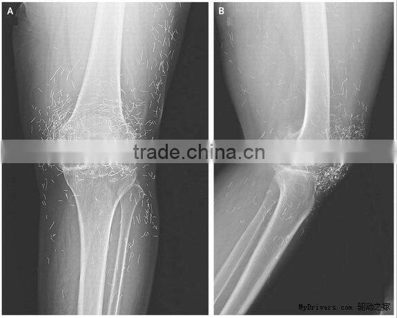 Konida dental hot sex 14*17 agfa medical filmagfa holder fuji dry film