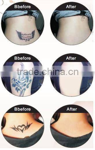 Big Movable Screen Powerful Active High power Laser tattoo removal machine with three heads Single Pulse 800mj